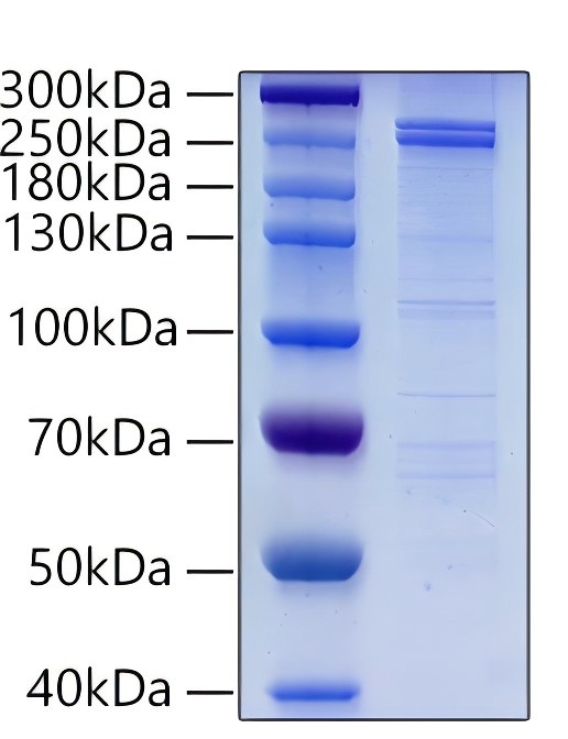 Recombinant Human DNMT1 Protein was determined by SDS-PAGE under reducing conditions with Coomassie Blue.