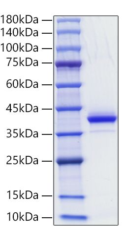 Recombinant Human CD81 Protein was determined by SDS-PAGE under reducing conditions with Coomassie Blue.