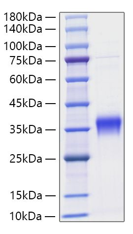 Recombinant Mouse IFN-beta Protein was determined by SDS-PAGE under reducing conditions with Coomassie Blue.