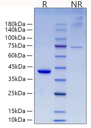 Recombinant Mouse RETN Protein was determined by SDS-PAGE under reducing (R).