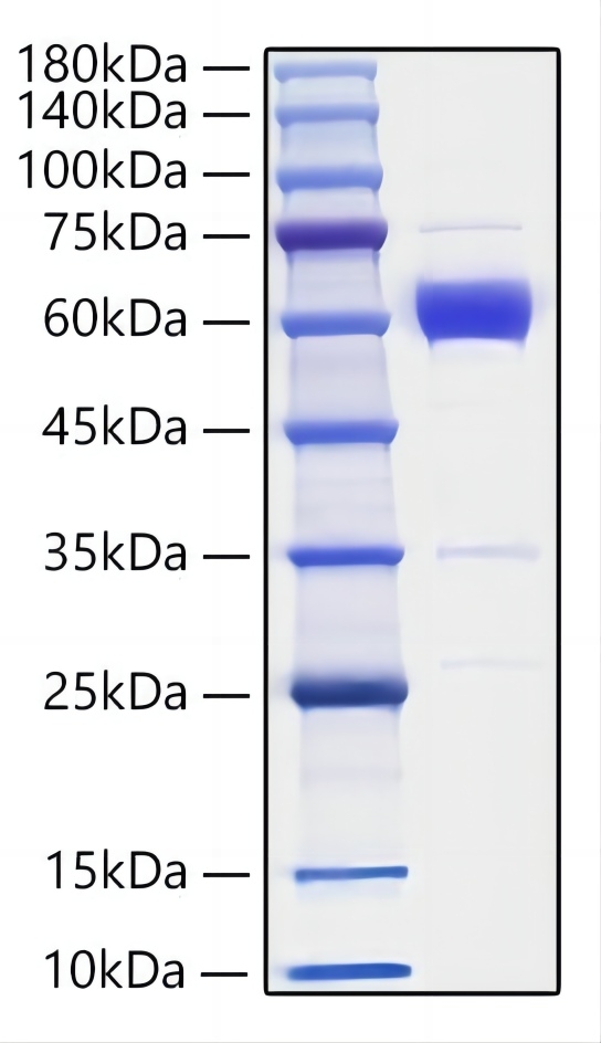 Recombinant Mouse IL-19 Protein was determined by SDS-PAGE under reducing conditions with Coomassie Blue.
