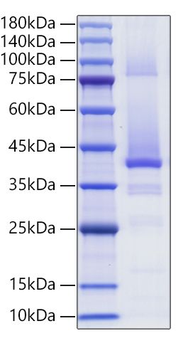 Recombinant Human IGF-II Protein was determined by SDS-PAGE under reducing conditions with Coomassie Blue.