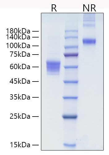 Recombinant Human NKG-2D/KLRK1/CD314 Protein was determined by SDS-PAGE under reducing (R)