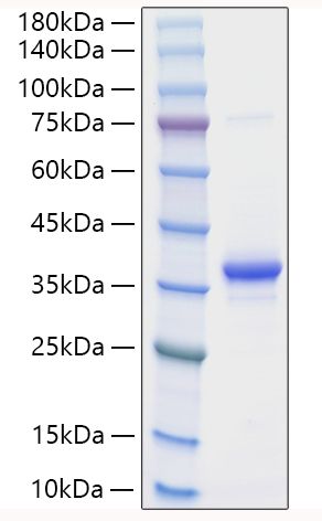 Recombinant Mouse EREG Protein was determined by SDS-PAGE under reducing conditions with Coomassie Blue.