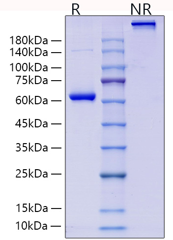 Recombinant Human Collagen II alpha 1/COL2A1 Protein was determined by SDS-PAGE under reducing (R) and non-reducing (NR) conditions.