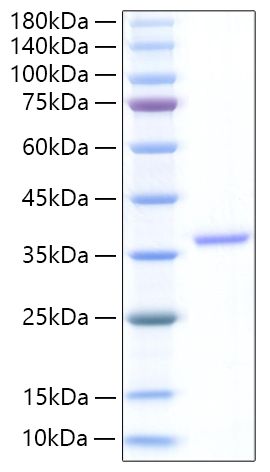 Recombinant Human EREG Protein was determined by SDS-PAGE under reducing conditions with Coomassie Blue.