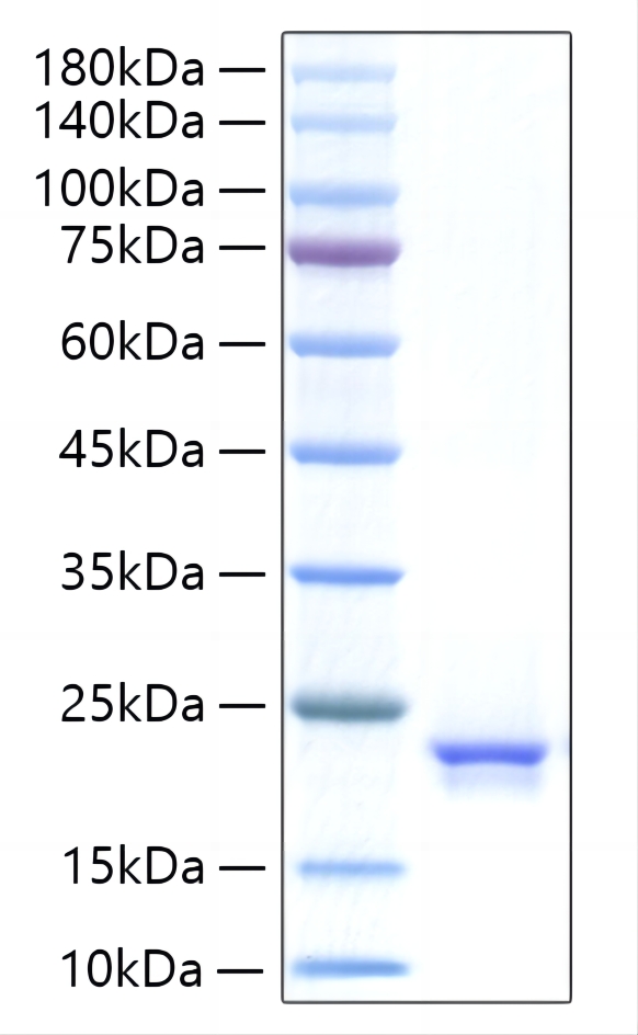 Recombinant Human IFN-alpha 21 Protein was determined by SDS-PAGE under reducing conditions with Coomassie Blue.