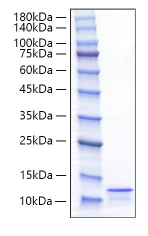 Recombinant Mouse CCL17/TARC Protein was determined by SDS-PAGE under reducing conditions with Coomassie Blue.