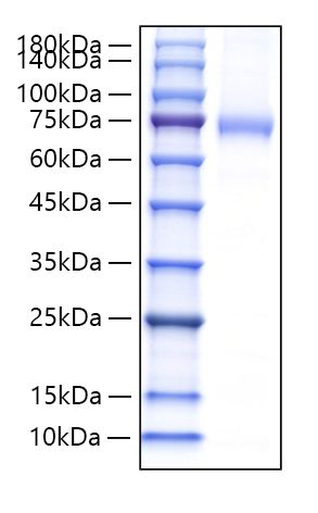 Recombinant Mouse Endoglin/ENG/CD105 Protein was determined by SDS-PAGE under reducing conditions with Coomassie Blue.