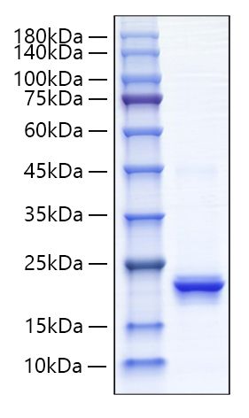 Recombinant Human IFN-alpha 4 Protein was determined by SDS-PAGE under reducing conditions with Coomassie Blue.