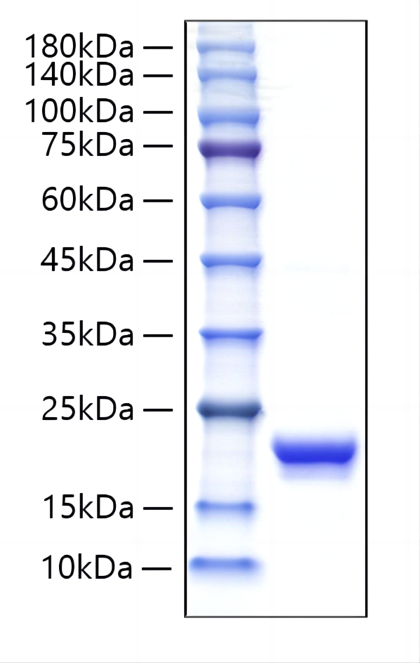 Recombinant Human IFN-alpha G/IFNA5 Protein was determined by SDS-PAGE under reducing conditions with Coomassie Blue.