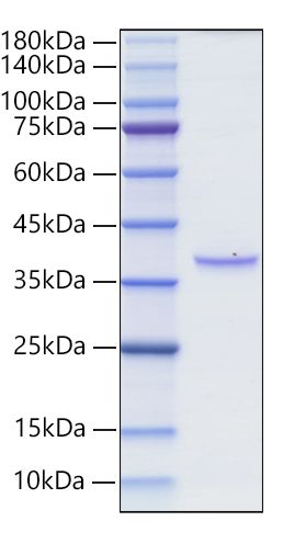 Recombinant Rat TNFRSF17/BCMA/CD269 Protein was determined by SDS-PAGE under reducing conditions with Coomassie Blue.