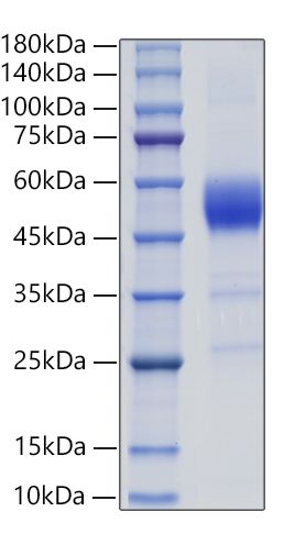 Recombinant Rat ALK-1/ACVRL1 Protein was determined by SDS-PAGE under reducing conditions with Coomassie Blue.
