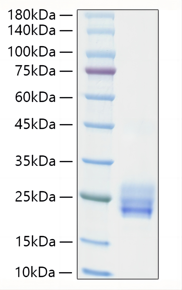 Recombinant Human IL-25/IL-17E Protein was determined by SDS-PAGE under reducing conditions with Coomassie Blue.