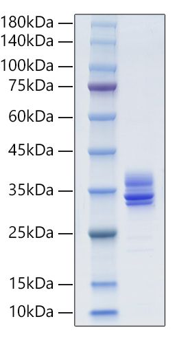 Recombinant Human MMP-7 Protein was determined by SDS-PAGE under reducing conditions with Coomassie Blue.