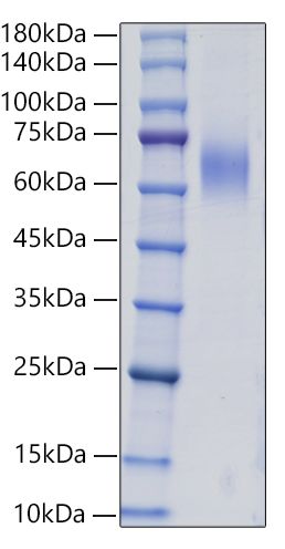Recombinant Human Mucin-2 /MUC2 Protein was determined by SDS-PAGE under reducing conditions with Coomassie Blue.