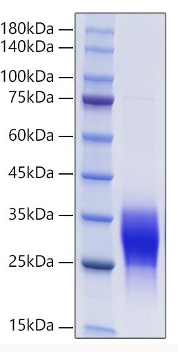 Recombinant Mouse Placenta growth factor/PLGF/PGF Protein was determined by SDS-PAGE under reducing conditions with Coomassie Blue.