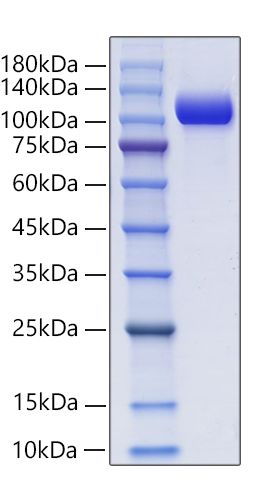 Recombinant Mouse NCAM-1/CD56 Protein was determined by SDS-PAGE under reducing conditions with Coomassie Blue.