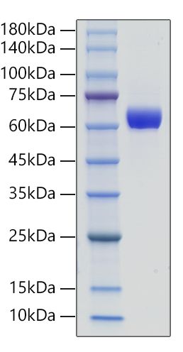 Recombinant Human IL-3R Beta/CSF2RB/CD131 Protein was determined by SDS-PAGE under reducing conditions with Coomassie Blue.
