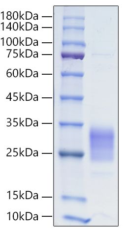 Recombinant Human IL-19 Protein was determined by SDS-PAGE under reducing conditions with Coomassie Blue.