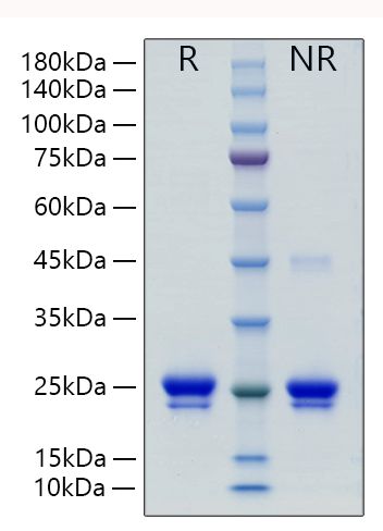 Recombinant Human Lipocalin-2/NGAL/LCN2 Protein was determined by SDS-PAGE under reducing .