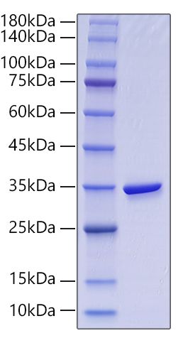 Recombinant Human Gamma-glutamyl hydrolase/GGH Protein was determined by SDS-PAGE under reducing conditions with Coomassie Blue.