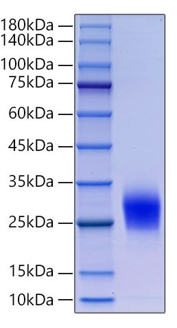 Recombinant Human Thy-1/CD90 Protein was determined by SDS-PAGE under reducing conditions with Coomassie Blue.