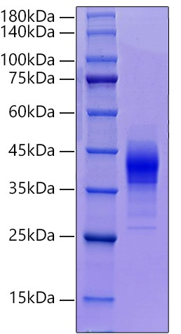 Recombinant Mouse Orosomucoid-1/ORM1 Protein was determined by SDS-PAGE under reducing conditions with Coomassie Blue.