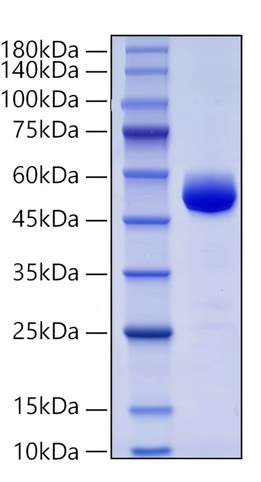 Recombinant Human Prostatic Acid Phosphatase /ACPP Protein was determined by SDS-PAGE under reducing conditions with Coomassie Blue.