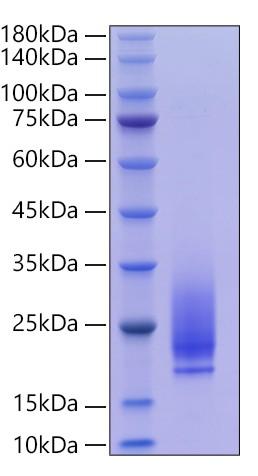 Recombinant Human AMHR2/MISR2 Protein was determined by SDS-PAGE under reducing conditions with Coomassie Blue.