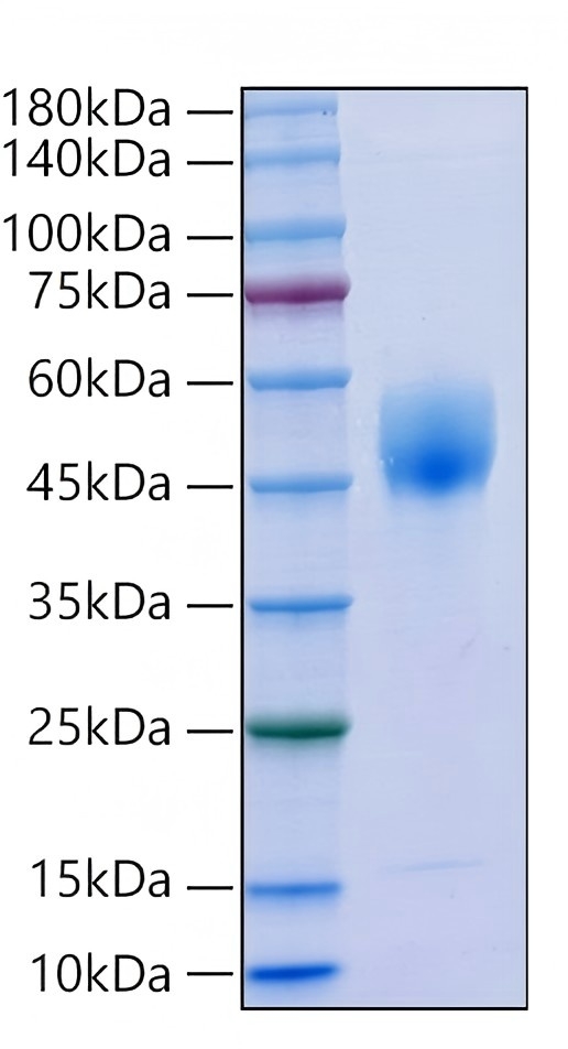 Recombinant Human LRG1(P133S) Protein was determined by SDS-PAGE under reducing conditions with Coomassie Blue.