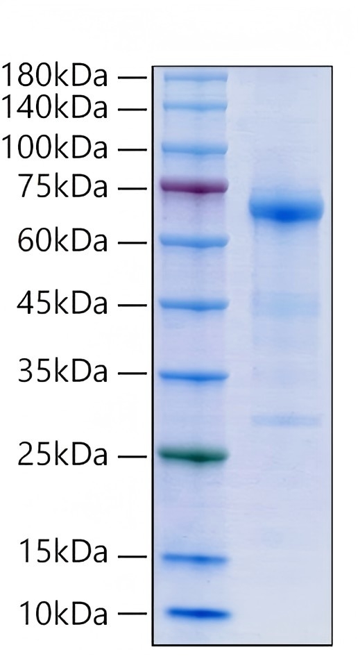Recombinant Human Alkaline phosphatase/tissue-nonspecific isozyme/ALPL Protein was determined by SDS-PAGE under reducing conditions with Coomassie Blue.