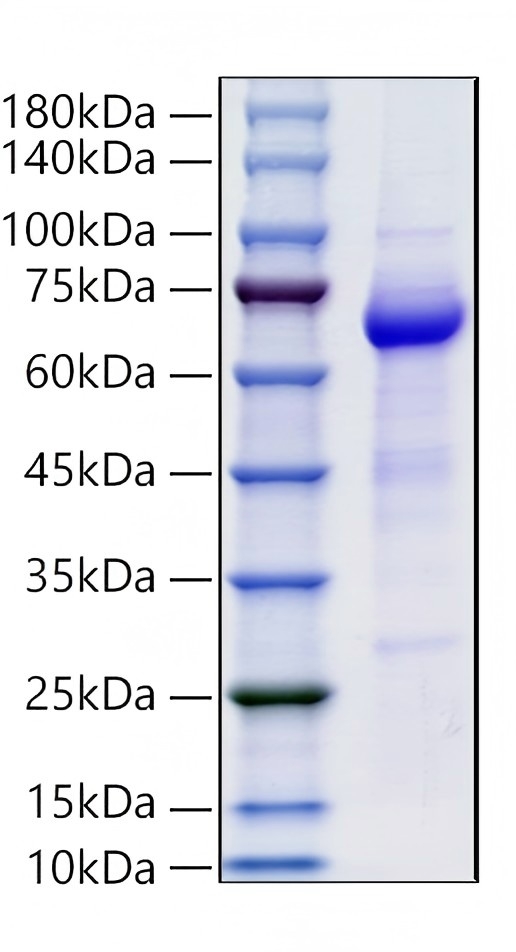 Recombinant Mouse Alkaline phosphatase,tissue-nonspecific isozyme/ALPL Protein was determined by SDS-PAGE under reducing conditions with Coomassie Blue.