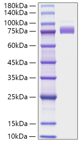 Recombinant Human Siglec-10 Protein was determined by SDS-PAGE under reducing conditions with Coomassie Blue.