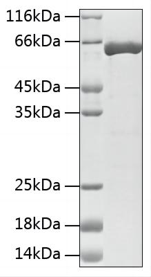 Recombinant Human HSP70 Protein was determined by SDS-PAGE under reducing (R) and non-reducing (NR) conditions.