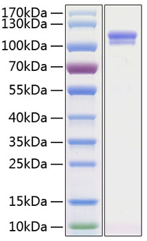 Recombinant Human Autotaxin/E-NPP2 Protein was determined by SDS-PAGE under reducing conditions with Coomassie Blue.