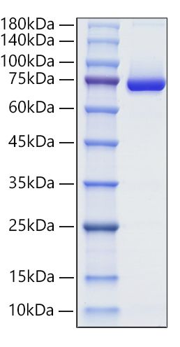 Recombinant Human Decorin/PG-S2/DCN Protein was determined by SDS-PAGE under reducing conditions with Coomassie Blue.