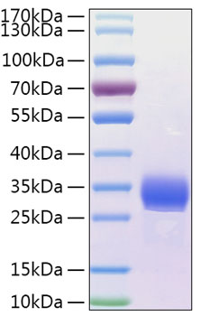Recombinant Human Angiopoietin-like 4/ANGPTL4(166-406) Protein was determined by SDS-PAGE under reducing conditions with Coomassie Blue.