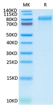 Recombinant Human Integrin beta-6/ITGB6 Protein was determined by SDS-PAGE under reducing conditions with Coomassie Blue.