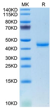 Recombinant Mouse Calcitonin/CALCA Protein was determined by SDS-PAGE under reducing (R) and non-reducing (NR) conditions.