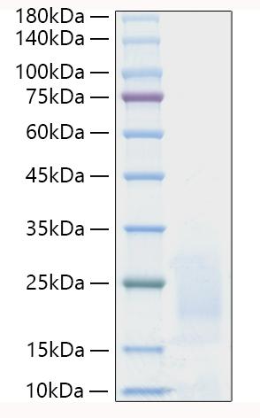 Recombinant Human Prostate stem cell antigen/PSCA Protein was determined by SDS-PAGE under reducing conditions with Coomassie Blue.