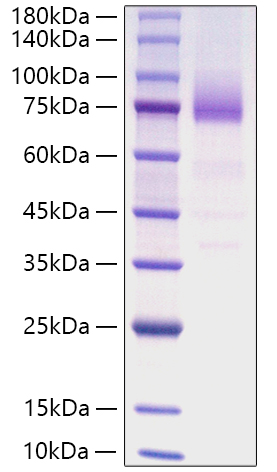 Recombinant Human SR-B3/CD36 Protein was determined by SDS-PAGE under reducing conditions with Coomassie Blue.