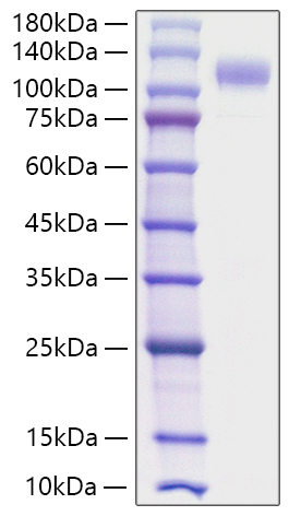 Recombinant Human Siglec-10 Protein was determined by SDS-PAGE under reducing conditions with Coomassie Blue.