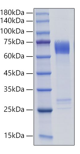 Recombinant Human MMP-8 Protein was determined by SDS-PAGE under reducing conditions with Coomassie Blue.