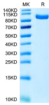 Recombinant Human PTK7/CCK4 Protein was determined by Tris-Bis PAGE under reducing conditions.