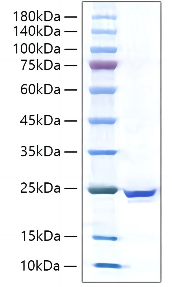 Recombinant Human IL-17C Protein was determined by SDS-PAGE under reducing conditions with Coomassie Blue.