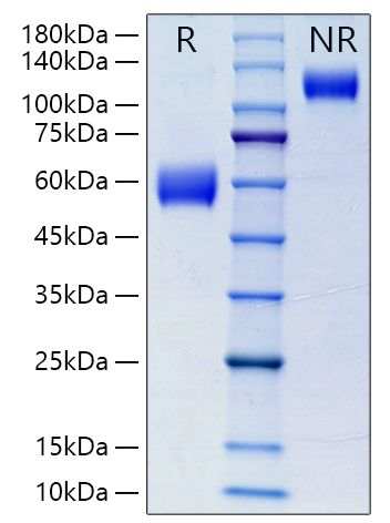 Recombinant Mouse NKG2-D/KLRK1/CD314 Protein was determined by SDS-PAGE under reducing (R) and non-reducing (NR) conditions.