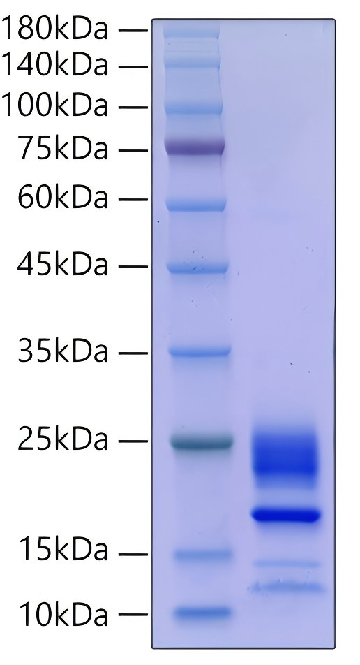 Recombinant Mouse IL-21 Protein was determined by SDS-PAGE under reducing conditions with Coomassie Blue.