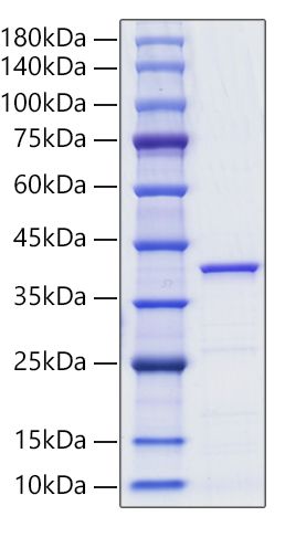 Recombinant Human Lactate Dehydrogenase A/LDHA Protein was determined by SDS-PAGE under reducing conditions with Coomassie Blue.