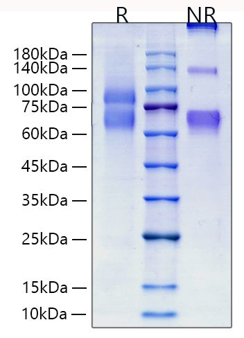Recombinant Human Tenascin C/TNC Protein was determined by SDS-PAGE under reducing conditions with Coomassie Blue.